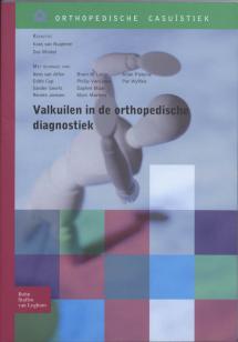 Valkuilen in orthopedische diagnostiek