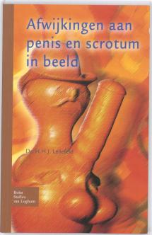 Afwijkingen aan penis en scrotum in beeld