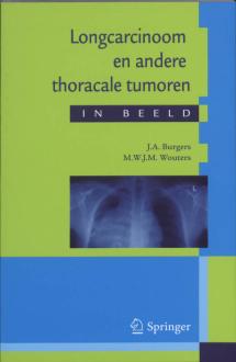 Longcarcinoom en andere thoracale tumoren in beeld