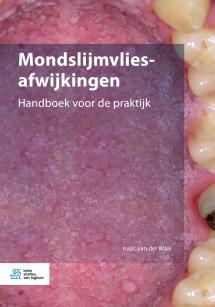 Mondslijmvliesafwijkingen